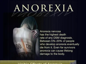 What Are The Symptoms Of Anorexia Nervosa