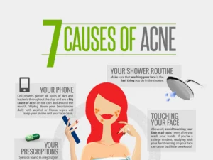 7 Causes And Foods That Can Trigger Your Acne [InfoGraphic]